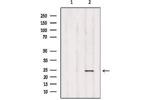 Western blot analysis of extracts from HepG2, using RAB35 Antibody. (RAB35 anticorps  (Internal Region))