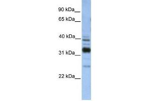 TXNDC13 antibody used at 1 ug/ml to detect target protein. (TMX4 anticorps  (C-Term))