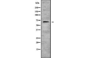 Western blot analysis FOXN1 using Jurkat whole cell lysates (FOXN1 anticorps  (N-Term))