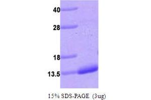 S100 Calcium Binding Protein A4 (S100A4) (AA 1-101) protein (His tag)