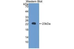 Detection of Recombinant RBP5, Rat using Monoclonal Antibody to Retinol Binding Protein 5, Cellular (RBP5) (Retinol Binding Protein 5 anticorps  (AA 19-201))