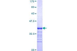 Image no. 1 for Kruppel-Like Factor 3 (Basic) (KLF3) (AA 1-69) protein (GST tag) (ABIN1308752)