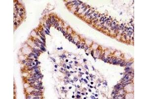 IHC testing of FFPE human colon with ABL2 antibody at 1:25. (ABL2 anticorps)