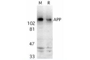 Image no. 1 for anti-Amyloid beta (A4) Precursor Protein (APP) (AA 737-751) antibody (ABIN319013) (APP anticorps  (AA 737-751))