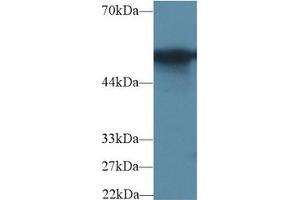 Western Blot; Sample: Rat Colon lysate; Primary Ab: 2µg/ml Rabbit Anti-Rat G6PD Antibody Second Ab: 0.