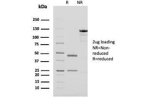 SDS-PAGE Analysis Purified PAPP-A Mouse Monoclonal Antibody (PAPPA/2718). (PAPPA anticorps  (AA 351-523))