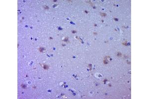 Paraformaldehyde-fixed, paraffin embedded human brain glioma, Antigen retrieval by boiling in sodium citrate buffer (pH6. (EGFR anticorps  (AA 951-1050))