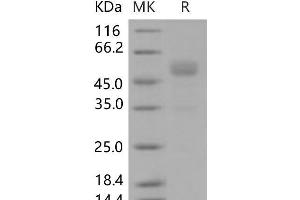 Western Blotting (WB) image for Frizzled Family Receptor 10 (FZD10) protein (Fc Tag) (ABIN7195856)