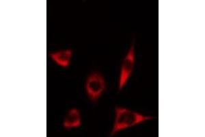 ABIN6274634 staining Hela cells by IF/ICC. (CYP17A1 anticorps  (Internal Region))