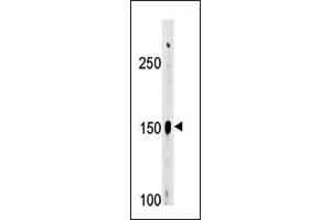 Image no. 1 for anti-ABL2 (ABL2) (Middle Region) antibody (ABIN358072) (ABL2 anticorps  (Middle Region))