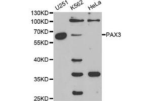 Western blot analysis of extracts of various cell lines, using PAX3 antibody (ABIN5970834) at 1/1000 dilution. (Paired Box 3 anticorps)