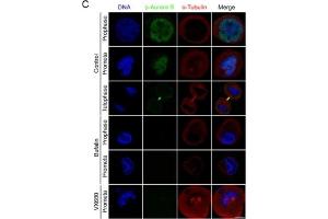 Bufalin prevents Aurora A recruitment to mitotic centrosomes and Aurora B recruitment to unattached kinetochores(A) HeLa cells were synchronized by a single thymidine treatment, released in the presence or absence of bufalin (100 nM) for 9 h, and stained for phospho-Aurora A (Green), α-tubulin (Red) and DNA (Blue). (Aurora Kinase B anticorps  (pThr232))