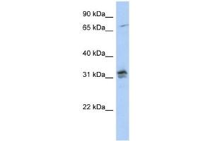 H1FOO antibody used at 1 ug/ml to detect target protein. (H1FOO anticorps  (N-Term))