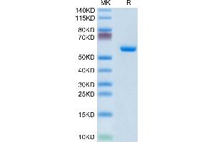 Human CLEC4A/DCIR on Tris-Bis PAGE under reduced condition. (CLEC4A Protein (AA 70-237) (Fc Tag))