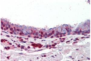 Human Lung, Respiratory Epithelium (formalin-fixed, paraffin-embedded) stained with PRMT1 antibody ABIN462306 followed by biotinylated goat anti-rabbit IgG secondary antibody ABIN481713, alkaline phosphatase-streptavidin and chromogen. (PRMT1 anticorps  (AA 317-346))