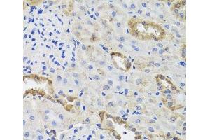 Immunohistochemistry of paraffin-embedded Rat kidney using HK3 Polyclonal Antibody at dilution of 1:100 (40x lens). (HK3 anticorps)