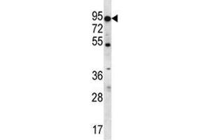 ABCD2 antibody western blot analysis in K562 lysate. (CCL17 anticorps  (AA 553-582))