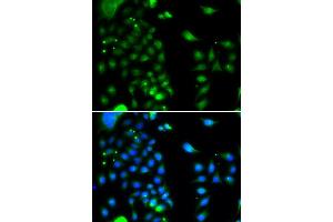 Immunofluorescence analysis of MCF-7 cells using UBE2J2 antibody. (UBE2J2 anticorps)