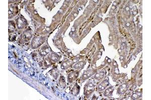 IHC analysis of ADA using anti-ADA antibody . (ADA anticorps  (AA 2-238))