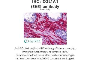 Image no. 2 for anti-Collagen, Type I, alpha 1 (COL1A1) (AA 1021-1108) antibody (ABIN1723789) (COL1A1 anticorps  (AA 1021-1108))