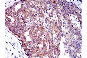 Immunohistochemistry (IHC) image for anti-Twinfilin, Actin-Binding Protein 1 (TWF1) (AA 335-384) antibody (ABIN1846307) (TWF1 anticorps  (AA 335-384))