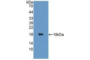 Detection of Recombinant PANK4, Human using Polyclonal Antibody to Pantothenate Kinase 4 (PANK4) (PANK4 anticorps  (AA 639-773))
