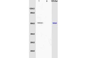 L1 human colon carcinoma lysate L2 mouse embryo lysates probed with Anti phospho-PPAR alpha(Ser12) Polyclonal Antibody, Unconjugated (ABIN753163) at 1:200 overnight at 4 °C. (PPARA anticorps  (pSer12))
