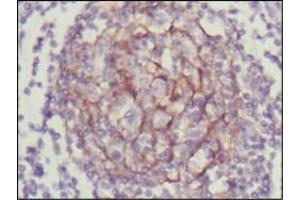 Immunohistochemical analysis of paraffin-embedded human lymph node using NTRK3 antibody with DAB staining. (NTRK3 anticorps  (AA 32-429))