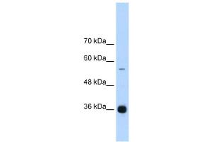 WB Suggested Anti-HNRPAB Antibody Titration:  1. (HNRNPAB anticorps  (C-Term))
