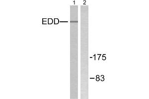 Western blot analysis of extracts from A549 cells, using EDD antibody.