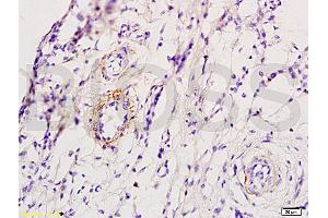 Formalin-fixed and skin of rat foot tissue labeled with Anti-ADRB1 Polyclonal Antibody, Unconjugated (ABIN669351) at 1:200 followed by conjugation to the secondary antibody and DAB staining