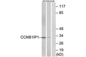 Western Blotting (WB) image for anti-Cyclin B1 Interacting Protein 1 (CCNB1IP1) (AA 201-250) antibody (ABIN2890282) (CCNB1IP1 anticorps  (AA 201-250))