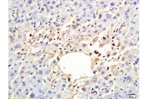 Formalin-fixed and paraffin embedded rat liver labeled with Anti-ARP4 Polyclonal Antibody, Unconjugated (ABIN708581) at 1:200 followed by conjugation to the secondary antibody (BAF53A anticorps  (AA 331-410))