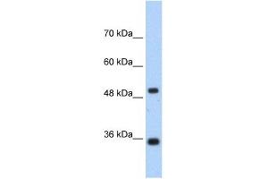 FBP1 antibody used at 1. (FBP1 anticorps  (N-Term))