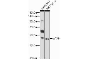 Western blot analysis of extracts of various cell lines, using WTAP antibody (ABIN7271372) at 1:1000 dilution. (WTAP anticorps  (AA 1-396))
