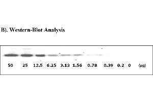 Image no. 5 for Signal Transducer and Activator of Transcription 1, 91kDa (STAT1) ELISA Kit (ABIN625231)