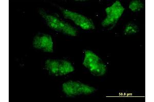Immunofluorescence of monoclonal antibody to EIF2AK2 on HeLa cell. (EIF2AK2 anticorps  (AA 1-100))