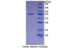 SDS-PAGE of Protein Standard from the Kit (Highly purified E. (L1CAM Kit ELISA)