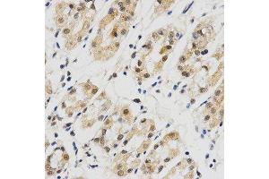 Immunohistochemistry (IHC) image for anti-Small Nuclear Ribonucleoprotein Polypeptide E (SNRPE) antibody (ABIN1876676) (SNRPE anticorps)