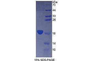 Image no. 1 for CD164 (CD164) (AA 24-162) protein (T7 tag,His tag) (ABIN6238714) (CD164 Protein (CD164) (AA 24-162) (T7 tag,His tag))
