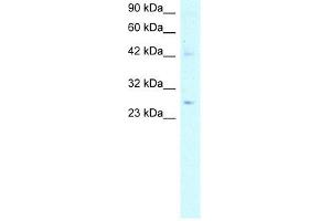 ACDC antibody used at 5 ug/ml to detect target protein. (ADIPOQ anticorps  (N-Term))