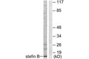 Western blot analysis of extracts from A549 cells, using Stefin B Antibody. (CSTB anticorps  (AA 49-98))