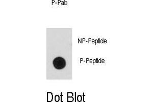 Image no. 2 for anti-BCL2-Associated Agonist of Cell Death (BAD) (pSer99) antibody (ABIN358087) (BAD anticorps  (pSer99))