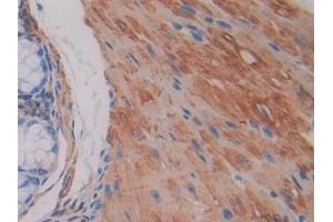 anti-Pyruvate Dehydrogenase Kinase, Isozyme 4 (PDK4) (AA 117-387) antibody