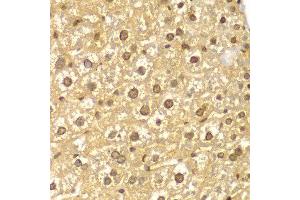 Immunohistochemistry of paraffin-embedded mouse liver using PYCARD antibody at dilution of 1:100 (400x lens). (STS anticorps)