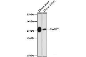 Western blot analysis of extracts of various cell lines using MAPRE3 Polyclonal Antibody at dilution of 1:3000. (MAPRE3 anticorps)