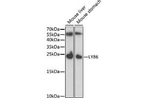 Western blot analysis of extracts of various cell lines, using LY86 antibody (ABIN6128208, ABIN6143395, ABIN6143396 and ABIN6221778) at 1:1000 dilution. (LY86 anticorps  (AA 21-162))