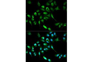 Immunofluorescence analysis of HepG2 cell using ADH5 antibody. (ADH5 anticorps)