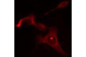 ABIN6275058 staining Hela cells by IF/ICC. (DGAT2L6 anticorps  (C-Term))
