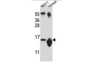 SNRPD3 Antibody (N-term) western blot analysis in MCF-7 cell line ans mouse heart tissue lysates (35µg/lane). (SNRPD3 anticorps  (N-Term))